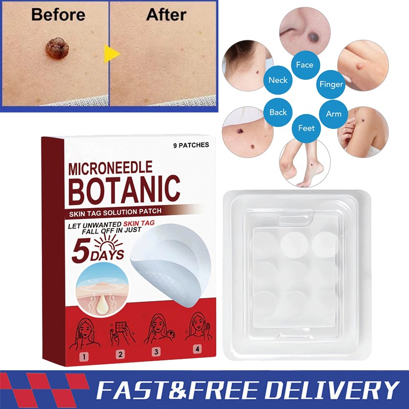 MICRONEEDLE BOTANIC Skin Tag & Acne Patch Skin Tag Remover Patches 9Pcs HOT 2026