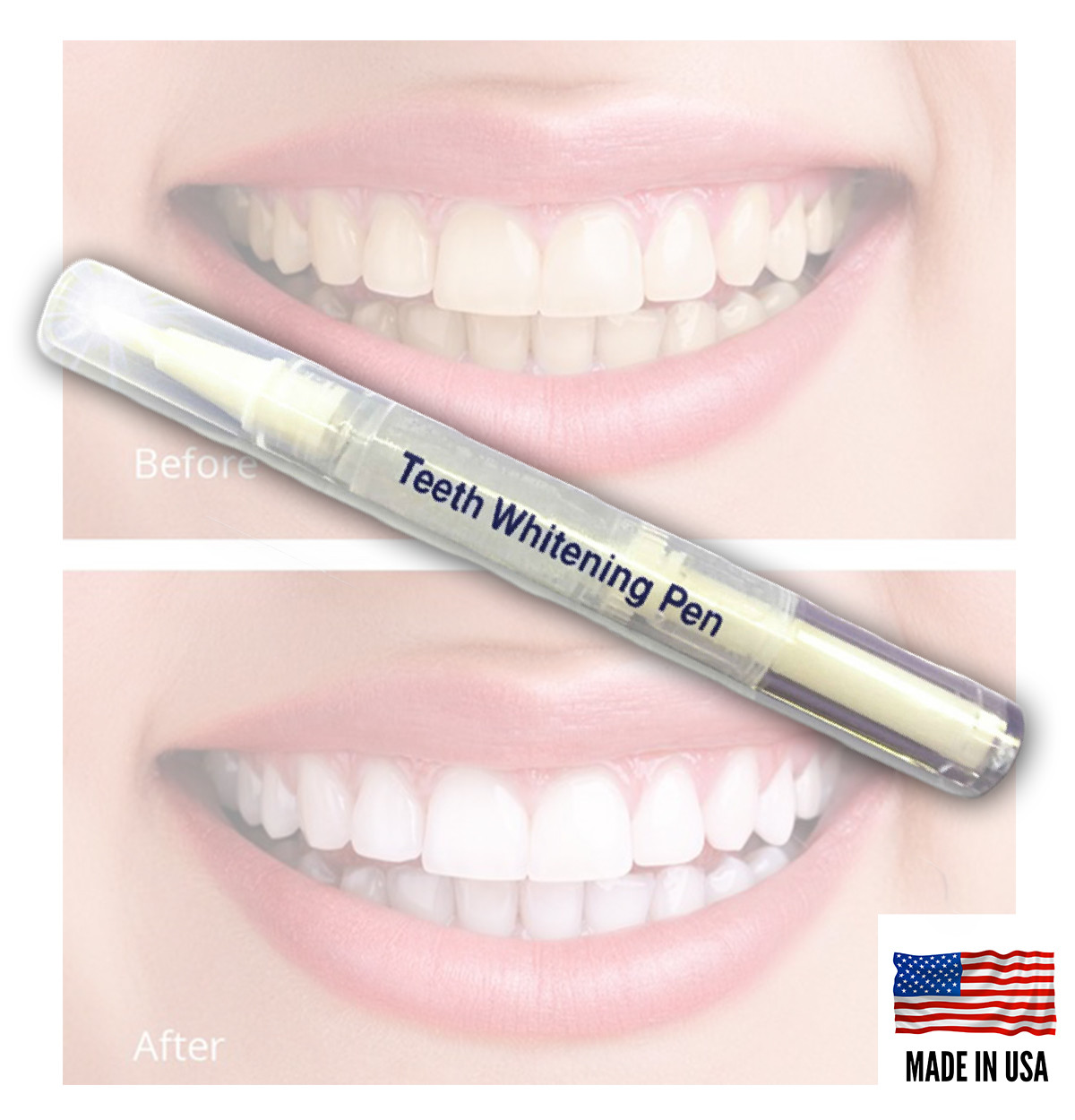 45% Peroxide Teeth Whitening Tooth Bleaching Whitener Pen Oral Gel System