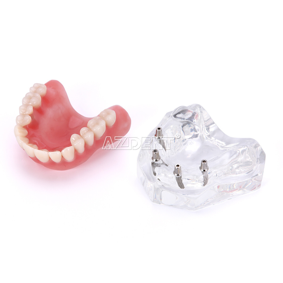 Dental Overdenture Implant Teeth Model Denture with implant Demonstration Clear