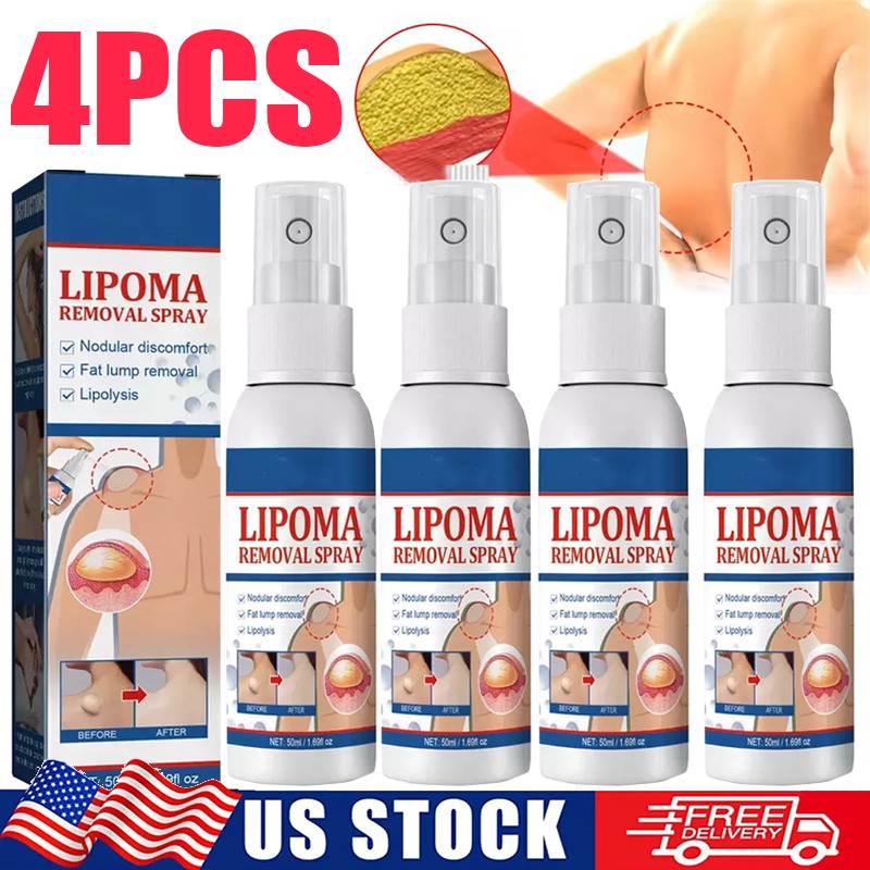 4X Lipomheilung Reduction Spray, Instant LumpFree Lipoma Removal Spray US