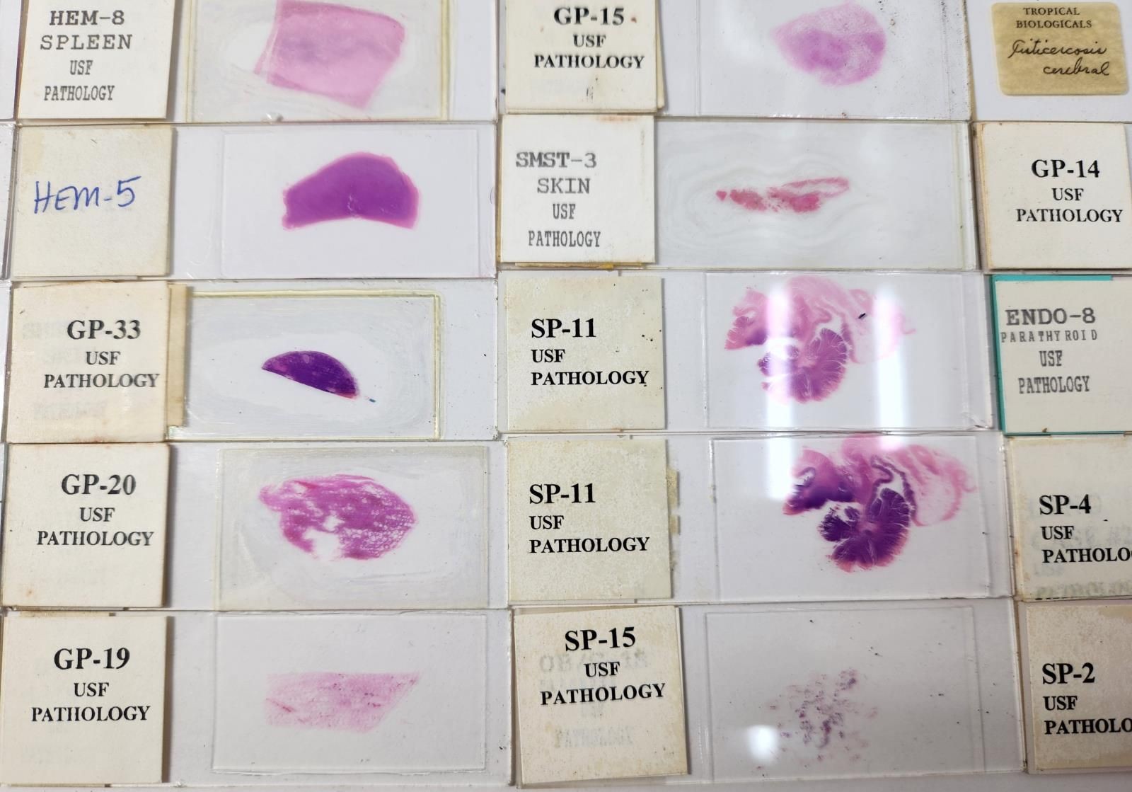 Lot Of 50 Vintage University Prepared Pathology Microscope Slides - Slides Only