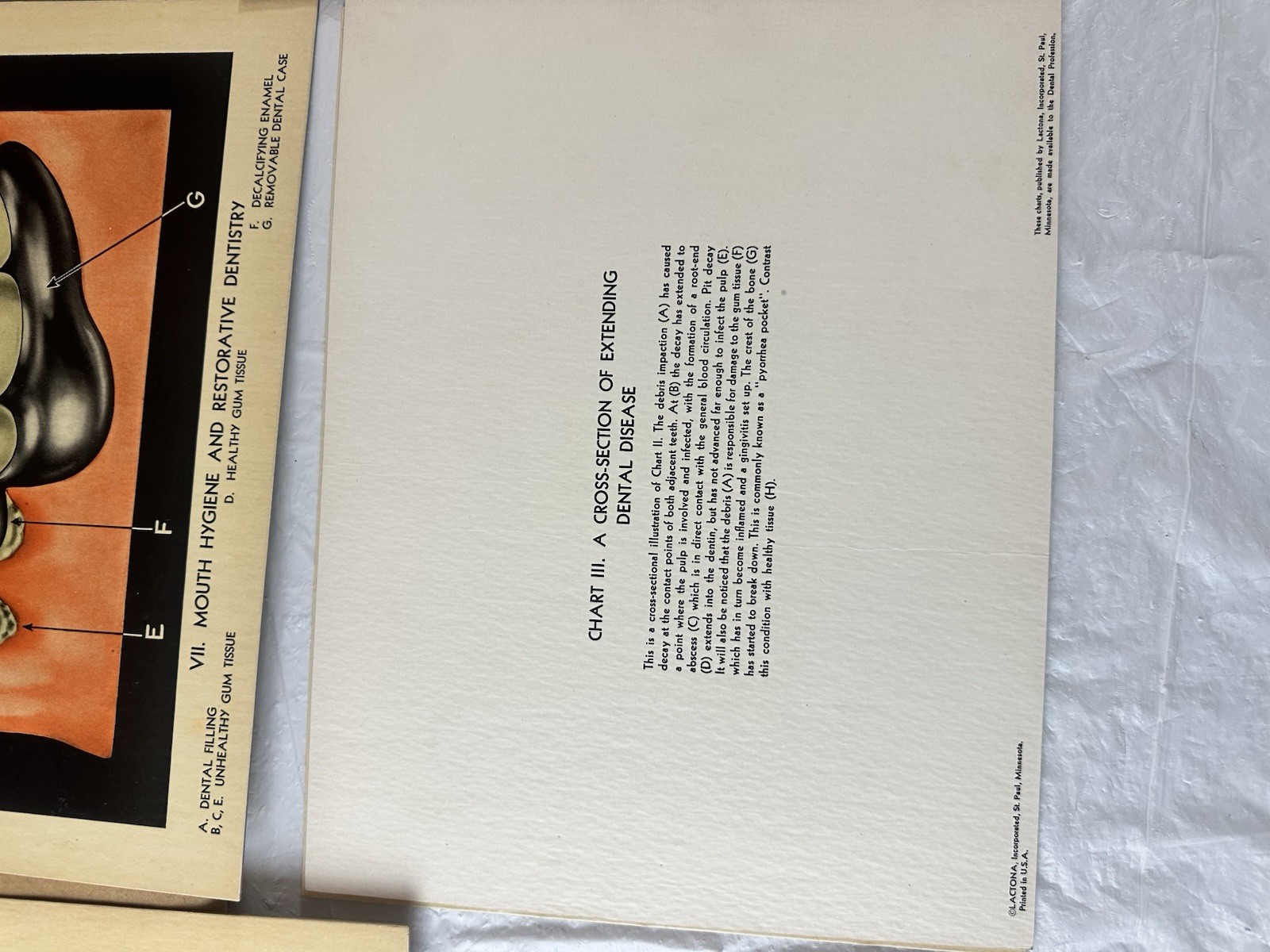 Vintage Lactona Inc Dental Anatomy Diagram Prints 11X8.5 Inches Dentistry