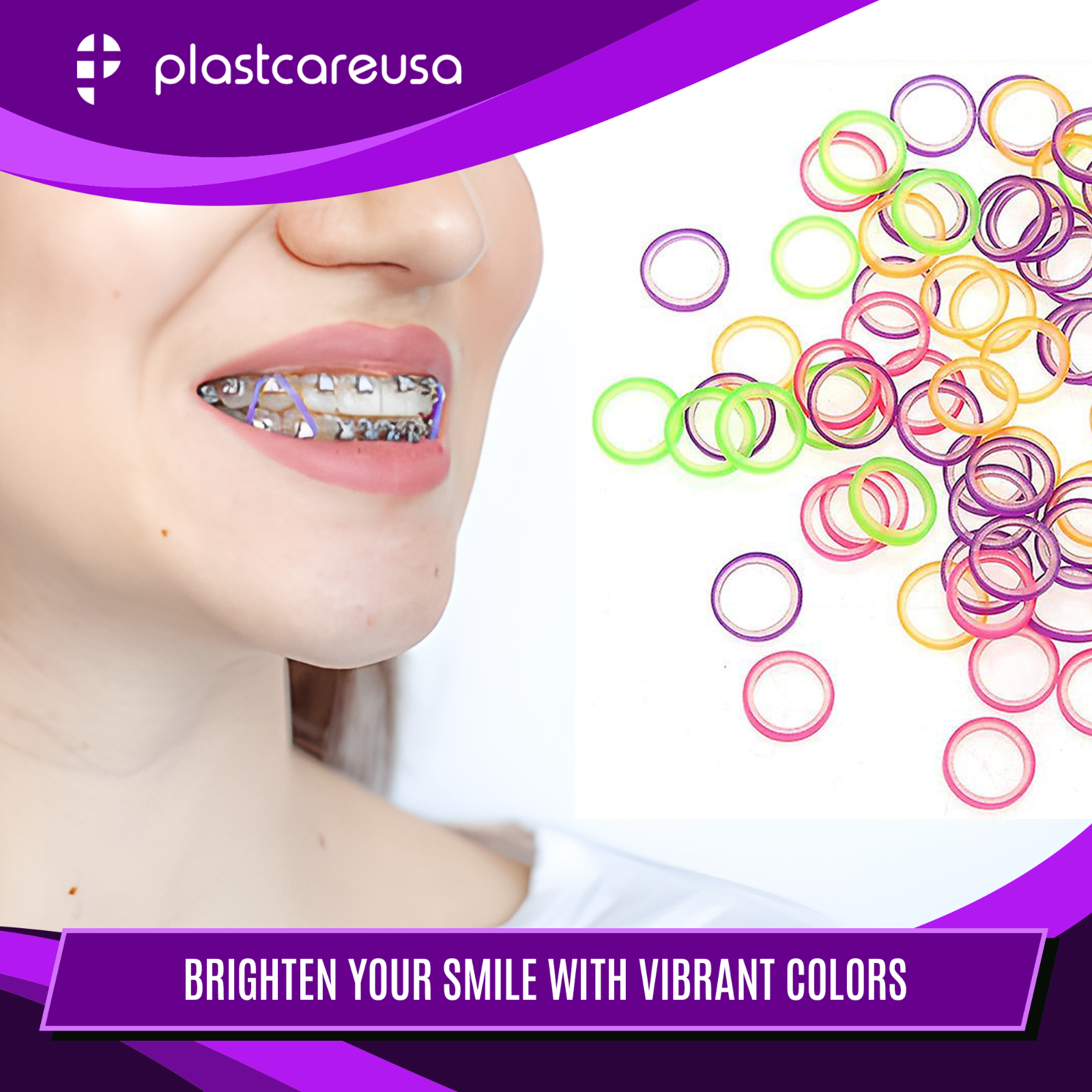 100 Assorted Color Light 3.5 Oz 3/16" Rabbit Latex Elastic Rubber Bands Braces