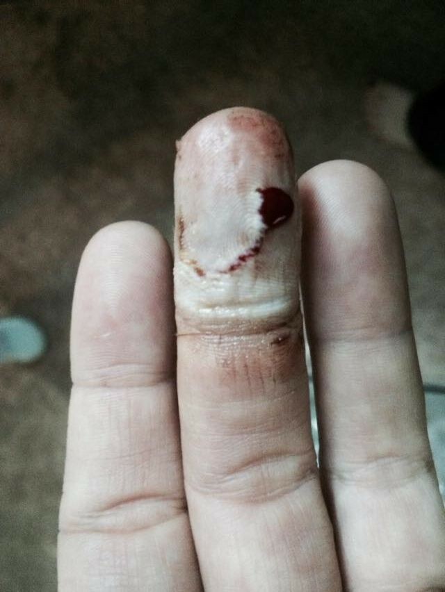 Grandmas Healing Products 1oz- Pine Tar Salve - A Black Drawing Ointment