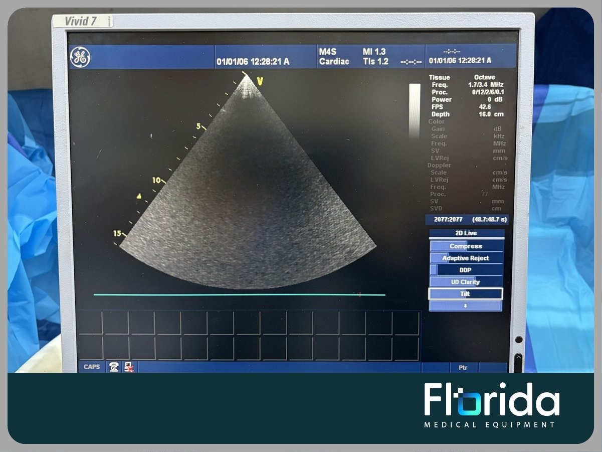 2012 GE M4S SECTOR ARRAY ULTRASOUND TRANSDUCER PROBE REF: 5129041 TESTED