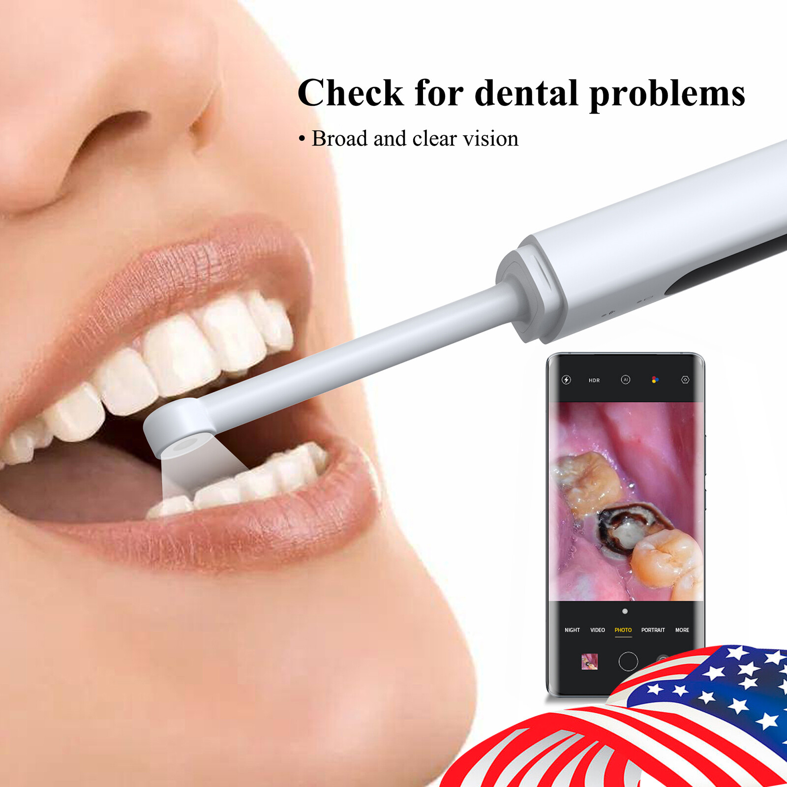Dental USB Intraoral Camera Oral Endoscope Digital Imaging Intra Oral images