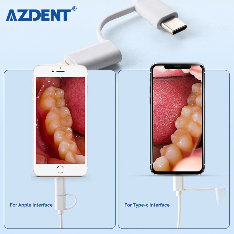 Dental HD USB Intraoral Camera Imaging Intra Oral Endoscope 8 LED 1440P