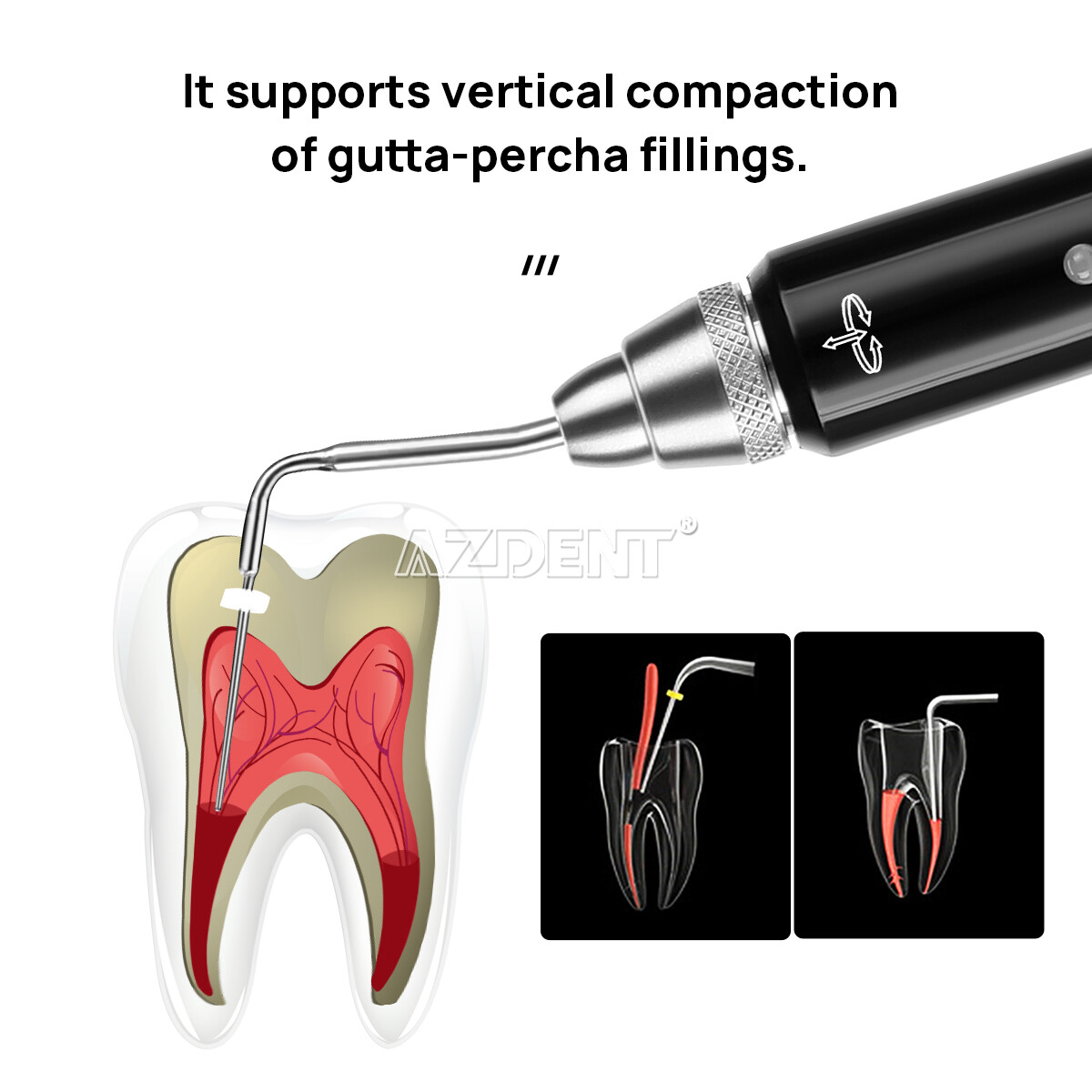 Sistema de obturación endodoncia dental pluma calentada/cortador de gutapercha