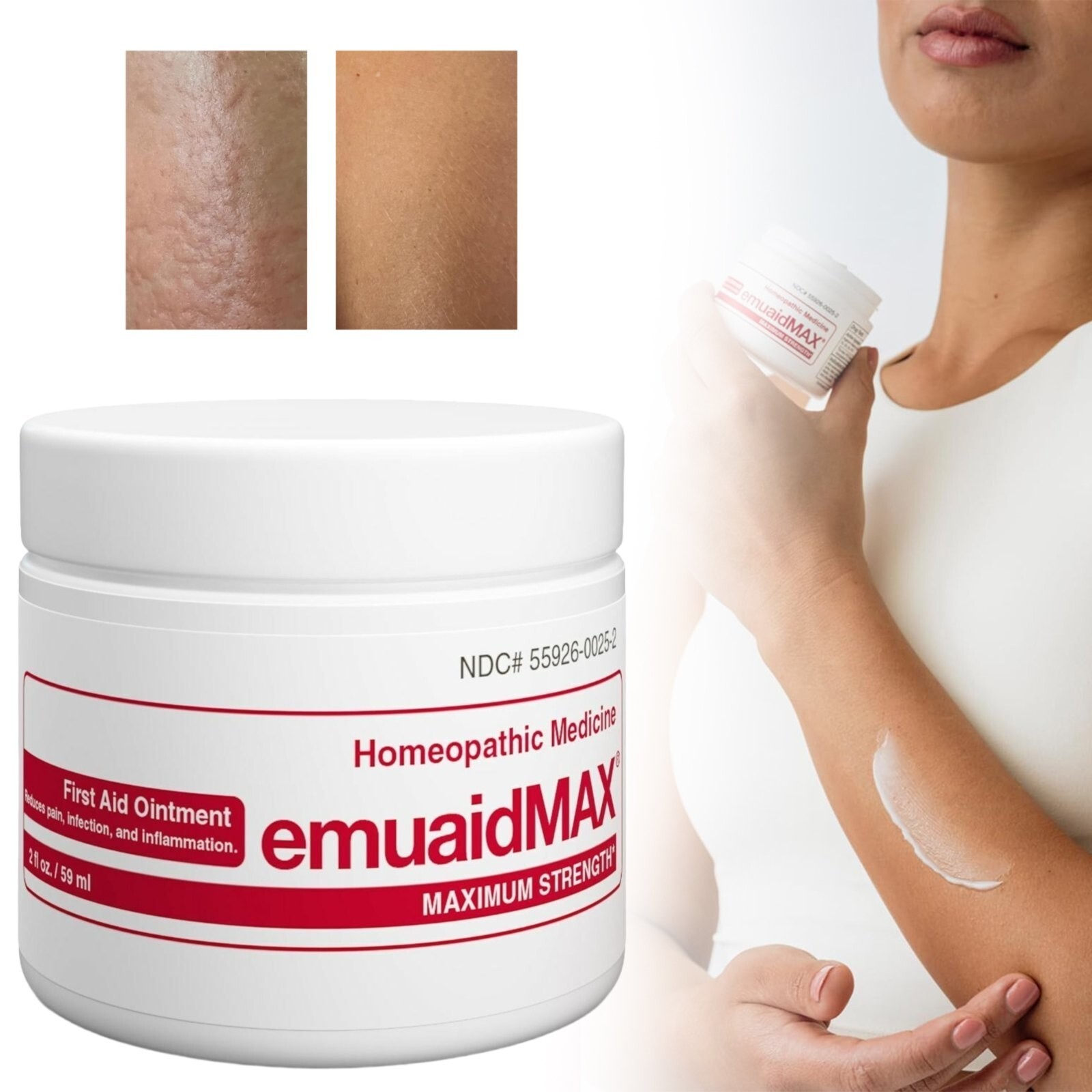 EMUAID Max First Aid Ointment For Reduces Pain, Infection, Inflammation 2oz.