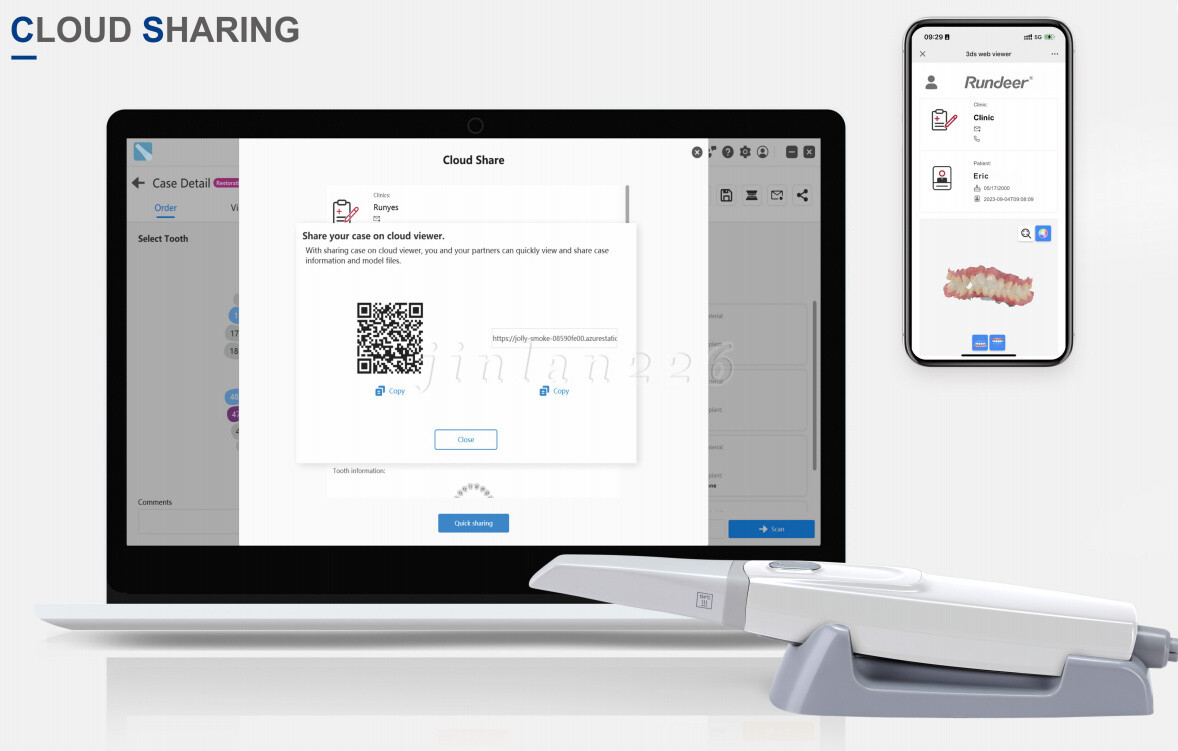 Dental Intra-oral Scanner 3D Real-time Display Software GreatLife w/Scanning SW