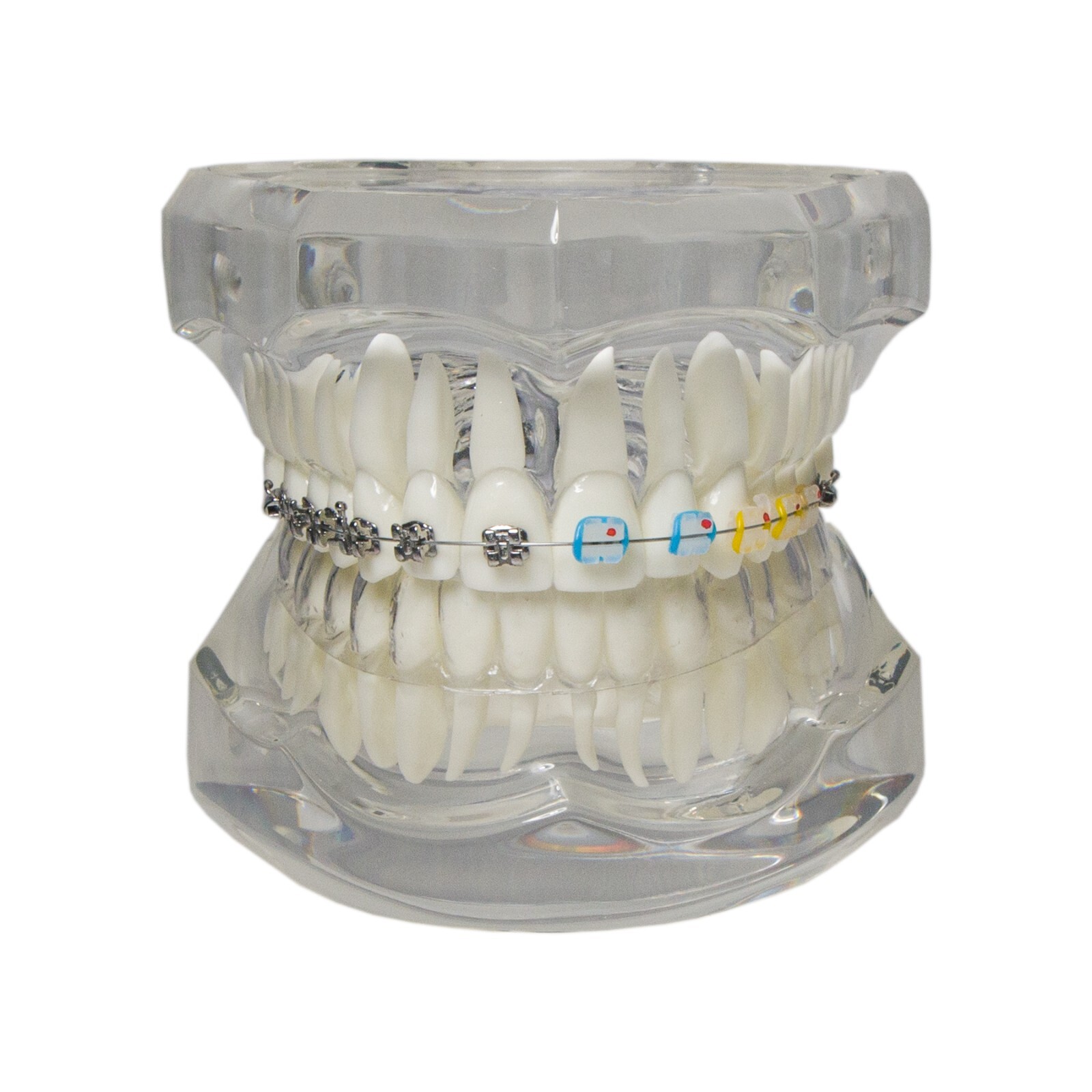 Dental Ortho Teeth Model With Metal Ceramic Brackets Lingual Braces Tube Teach