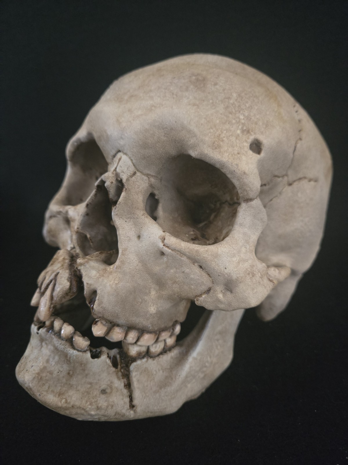 Human Skull Life Size Replica with battle wounds Realistic - Momento Mori