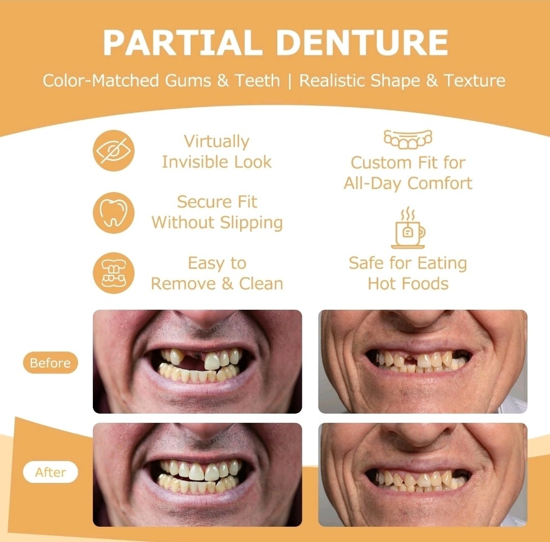 Partial Dentures - Dentures for Missing Teeth & Gaps - Lightweight & Unbreaka...