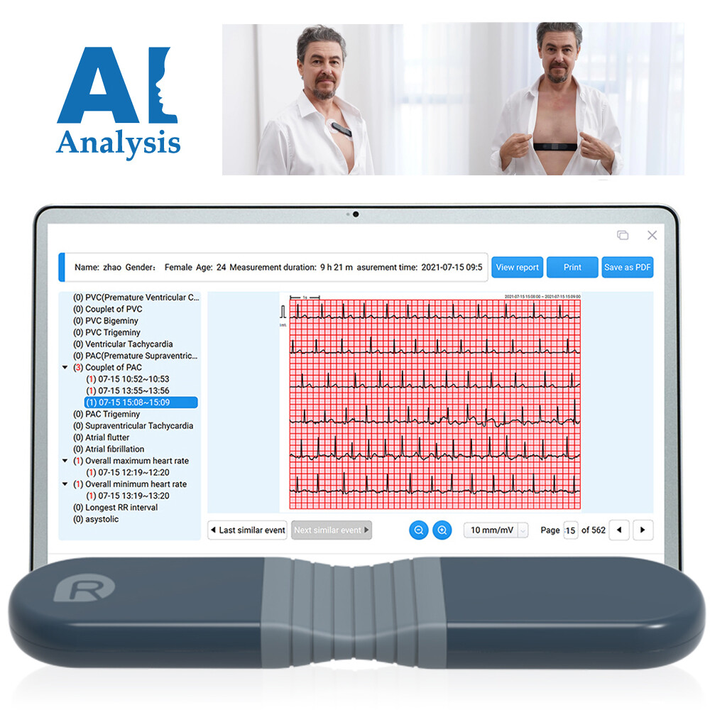 US stock Wellue Portable Dynamic ECG EKG Holter Recorder 24 Hours PC AI analysis