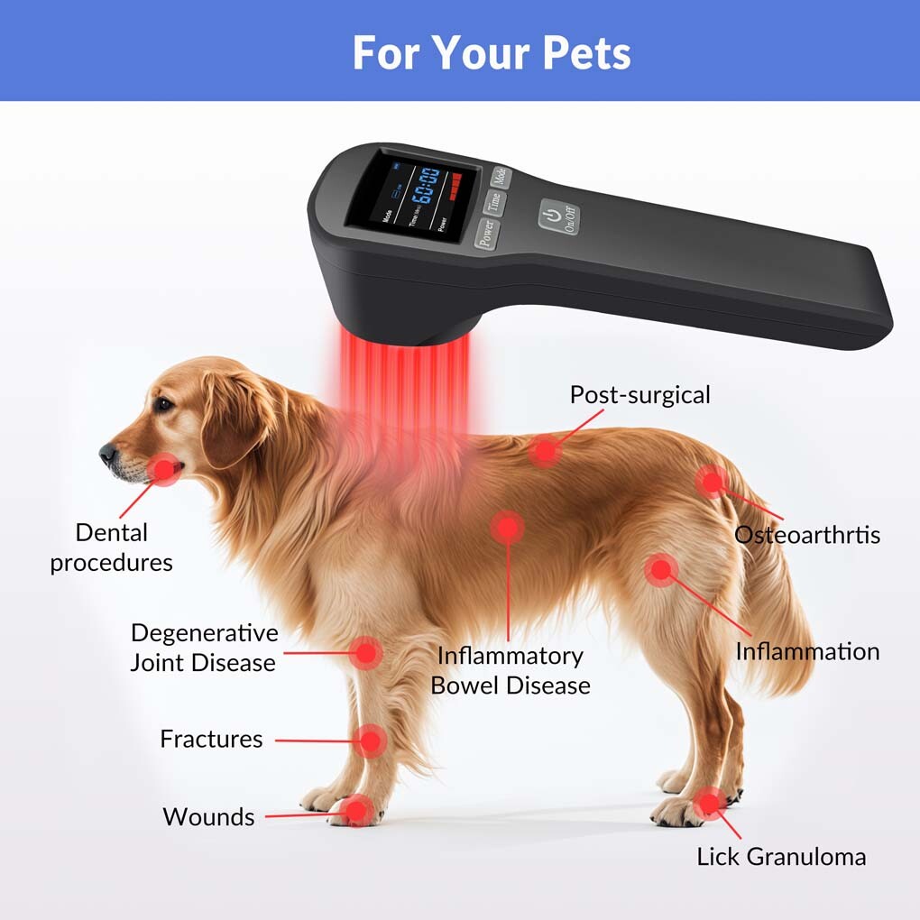 LLLT Cold Laser Therapy Device 650nm*16+808nm*4 for Fibromyalgia & Neuropathy
