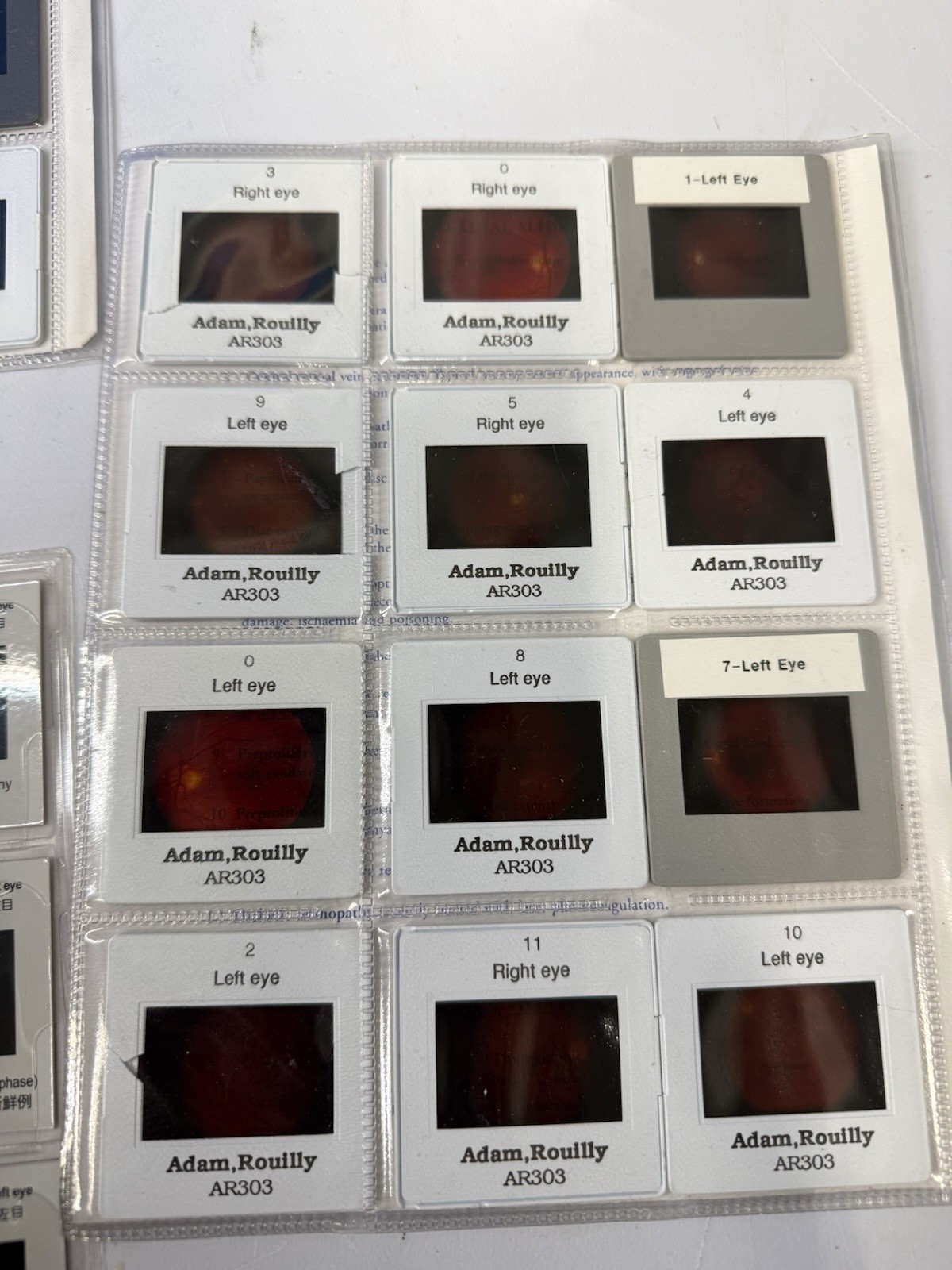 Kyoto Kagaku M82A EYE Examination Simulator Head (2 Steps) -Pls Read Description