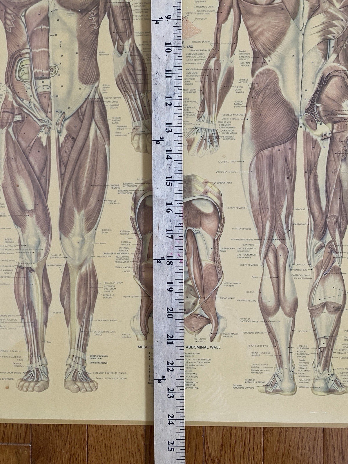 VTG Medical Poster Anatomical Chart Co Muscular Sys Laminated Peter Bachin 24x20