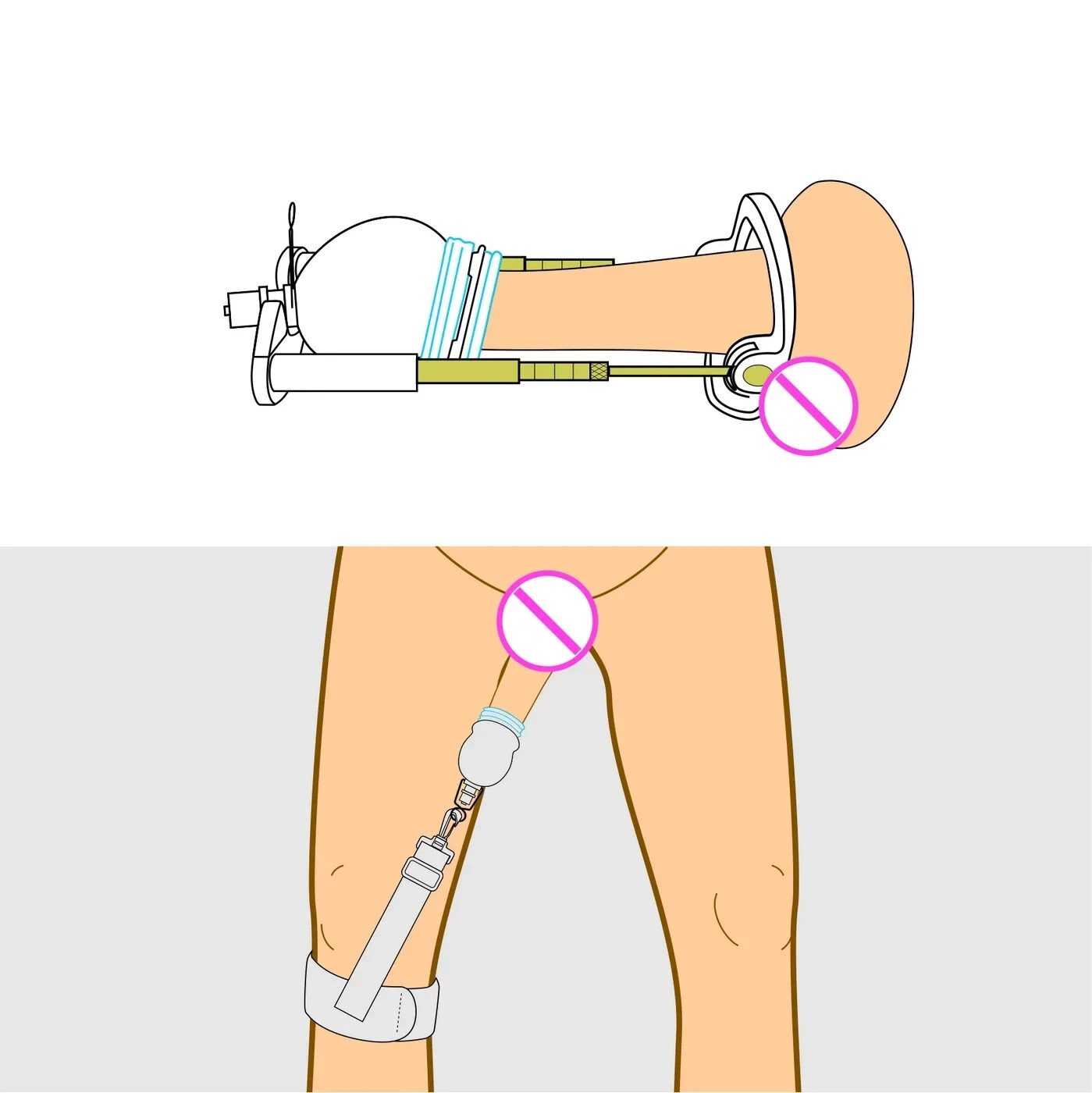 Male Physical Penis Extender Enlargement Device Penis Vacuum Cup+Leg Belt