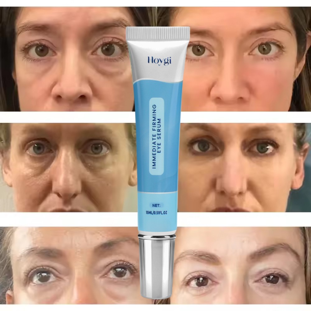 Under Eye Cream Remove Dark Circles Bags Face Lines Ageless Wrinkles Puffy Eye-