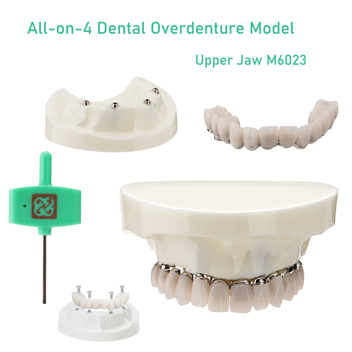 Dental All-on-4 Overdenture Model Dental Upper Jaw Implants Restoration 4 Screws