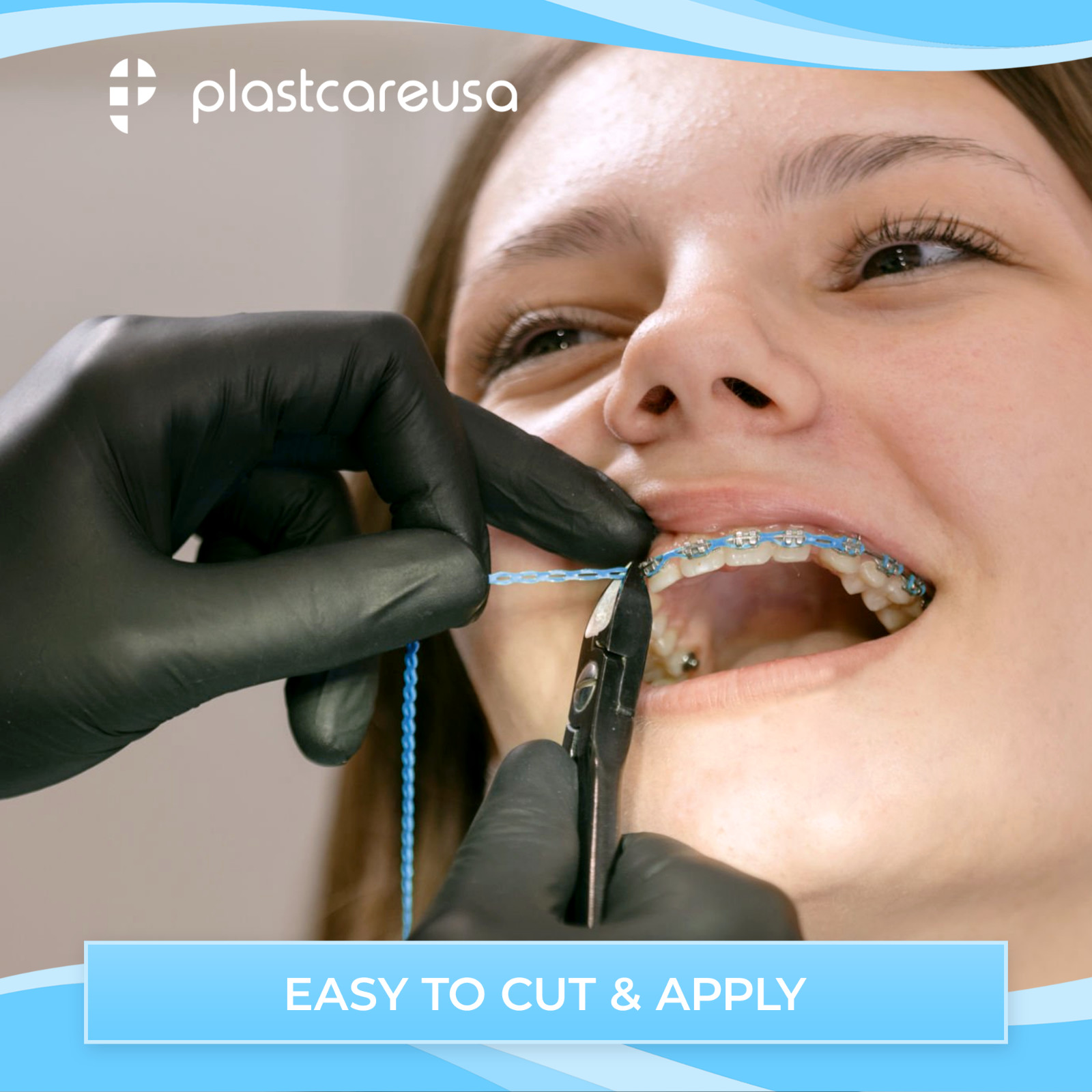 Orthodontic Dental Power Chain for Braces – 15 ft, Short, Long, Closed Elastic