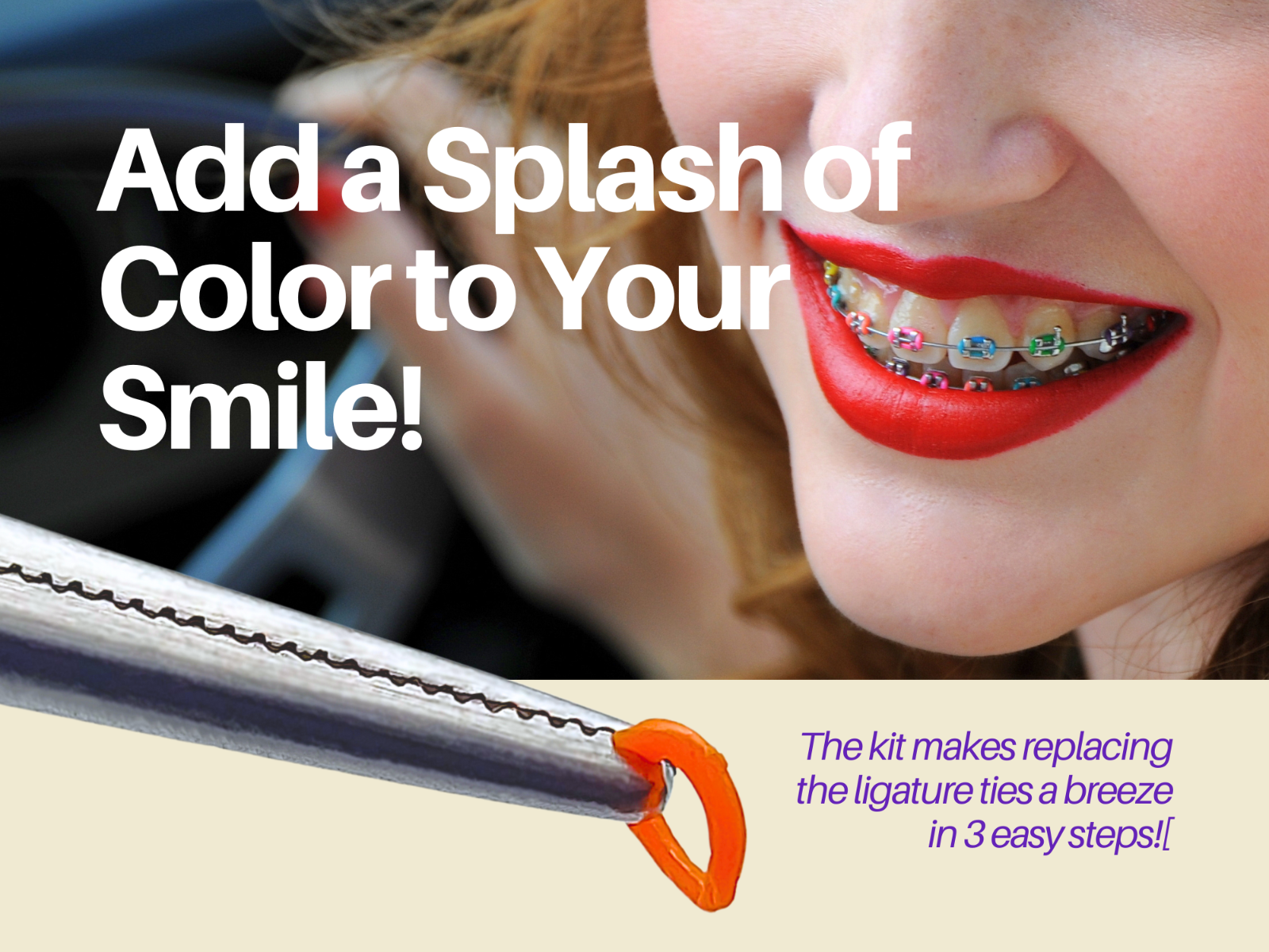 Dental Braces Color Changing Kit, Orthodontic Ties Changing kit ARTMAN