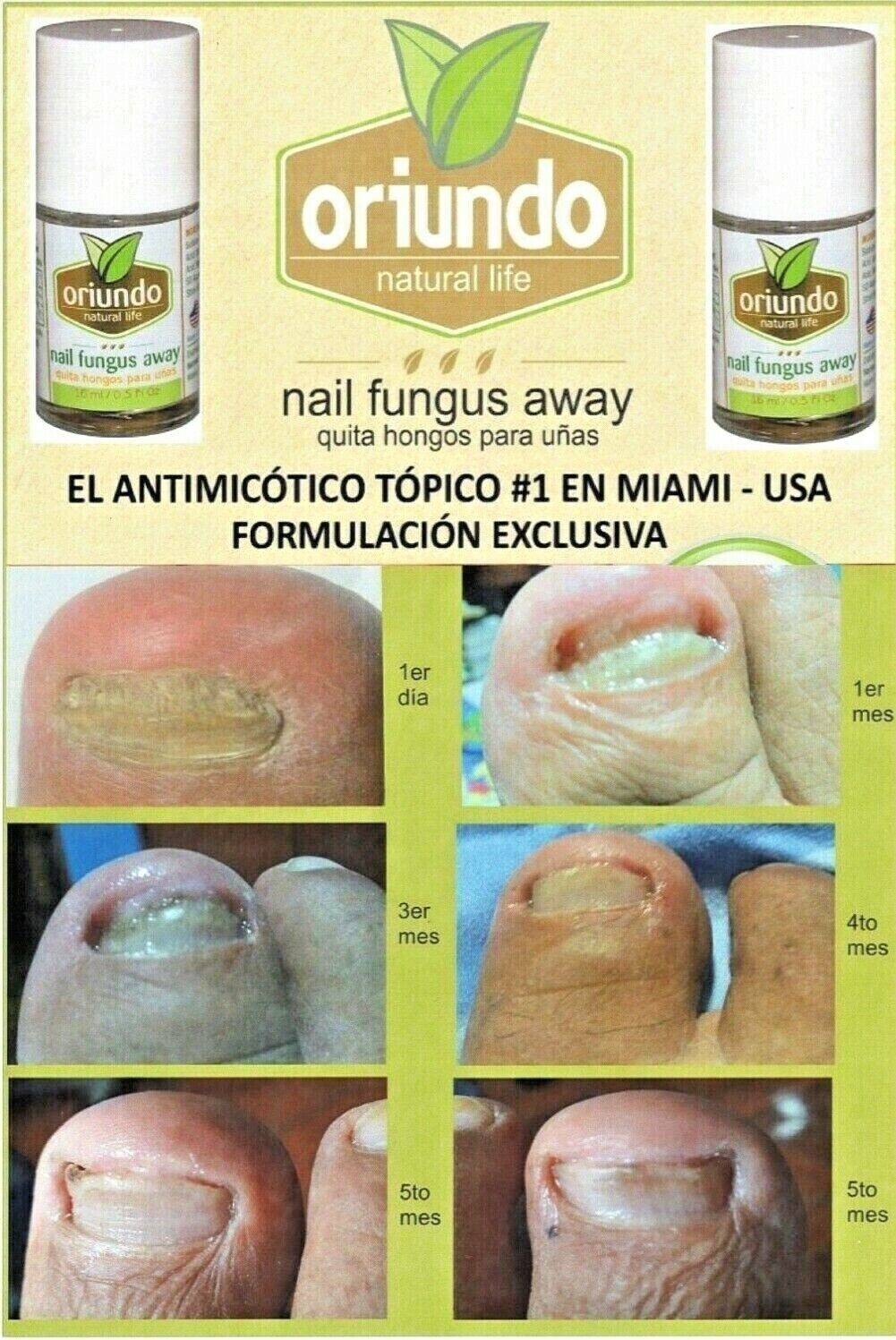 ORIUNDO Natural Life / Nail Fungus Away (Quita Hongos para Uñas) 0.5 Oz New USA
