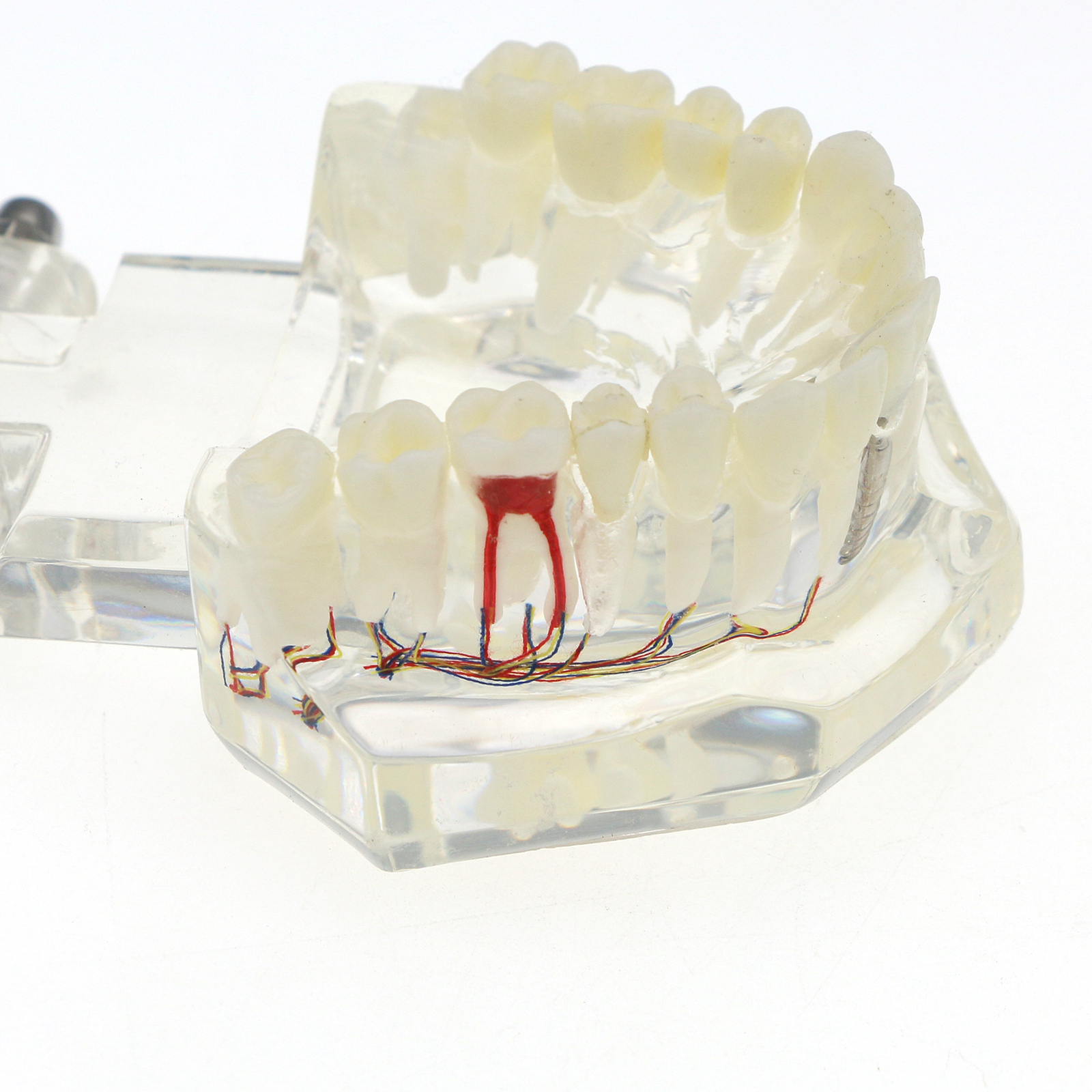 Dental Oral Typodont Model Implant Pathological Teaching Standard Size (Clear)