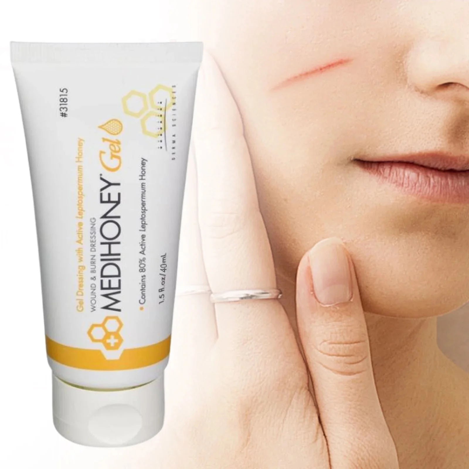 Medi*Honey - 1.5 oz Gel Wound Care & Dressings Tube Medical Grade Honey Gel 40ml