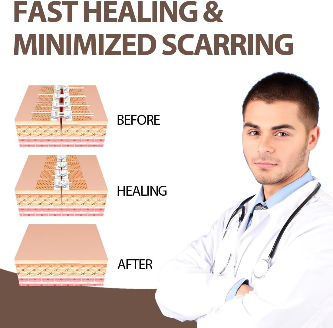 Wound Closure Strips 5Pcs Emergency Laceration Closures Butterfly Stitches Sutur