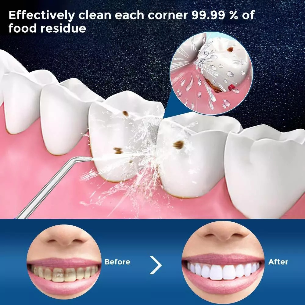 Water Cordless Water Flosser Dental Oral Irrigator Teeth Cleaner Floss 6 Tips