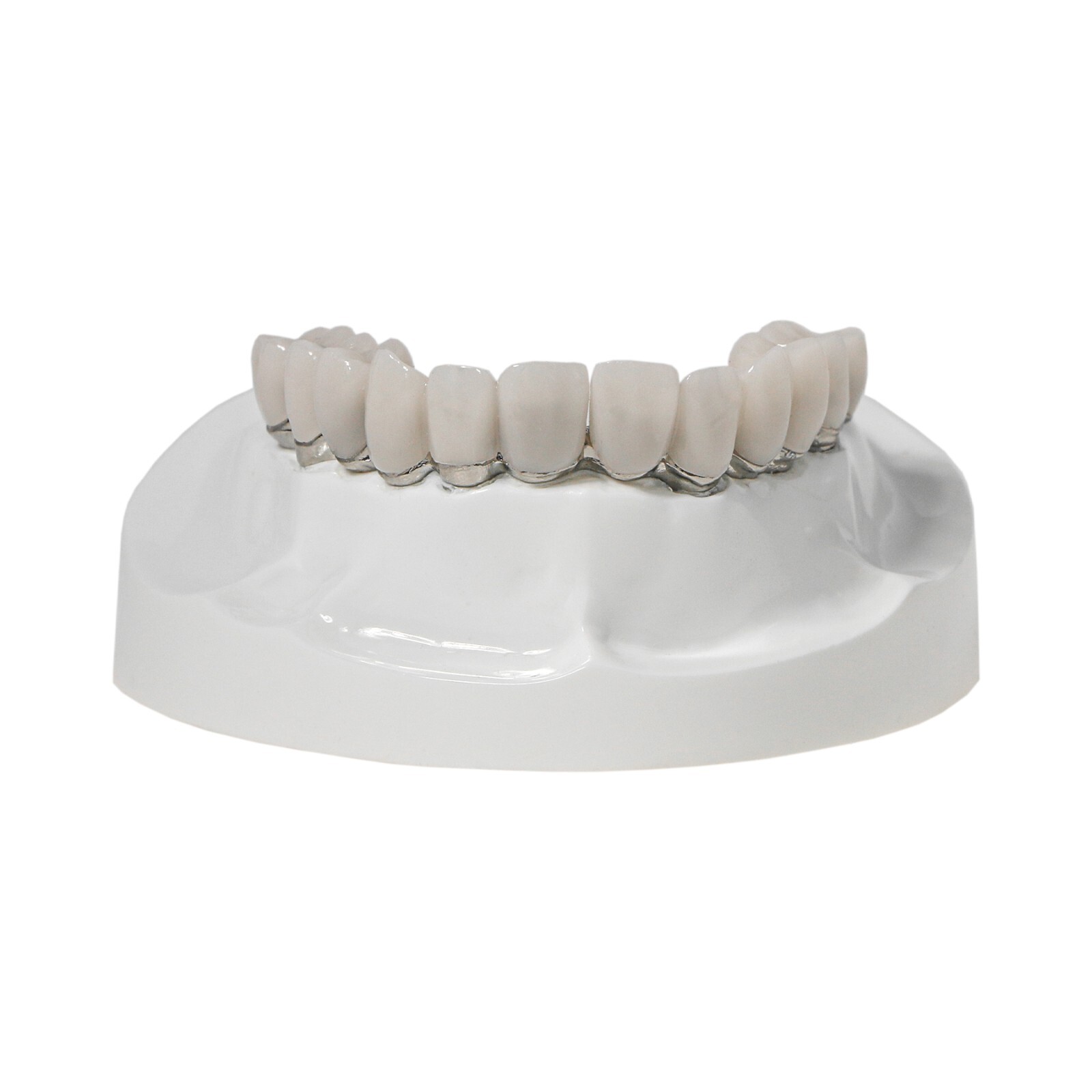 Dental Implant Typodont Teeth Restoration Model Series Overdenture Practice Demo