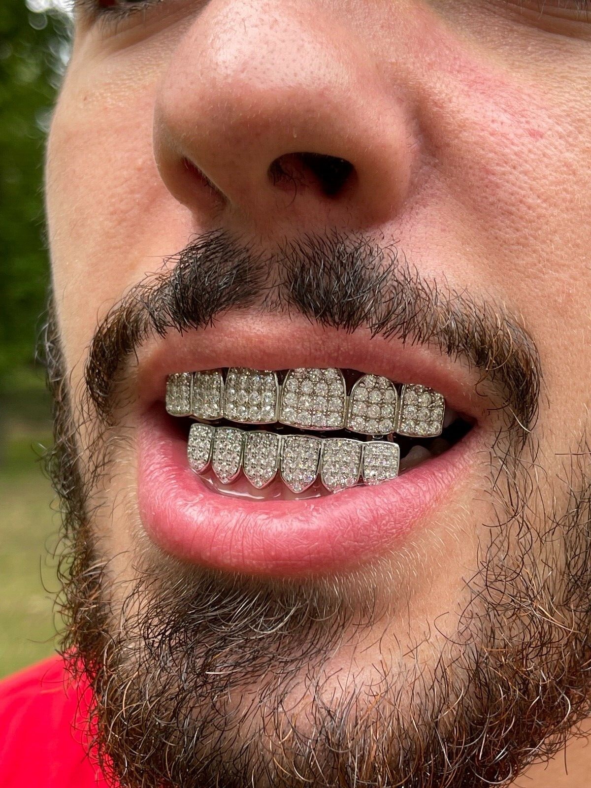 MOISSANITE GRILLZ Passes Test Teeth Top & Bottom Hip Hop 925 Silver Iced Rapper