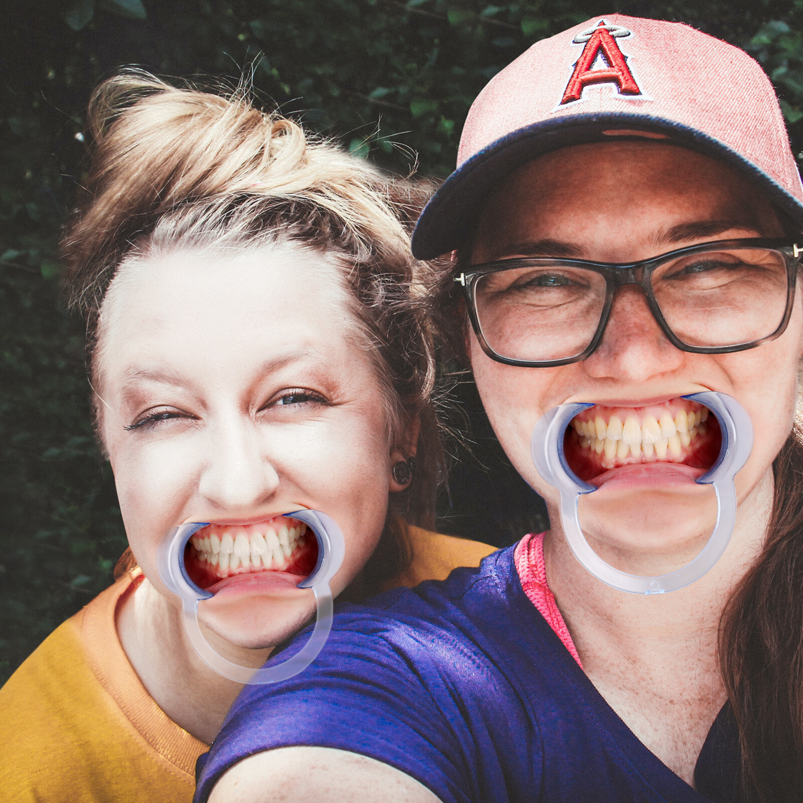 3pcs/set Dental C-type Cheek Retractor Mouth Opener Autoclavable S+M+L Blue