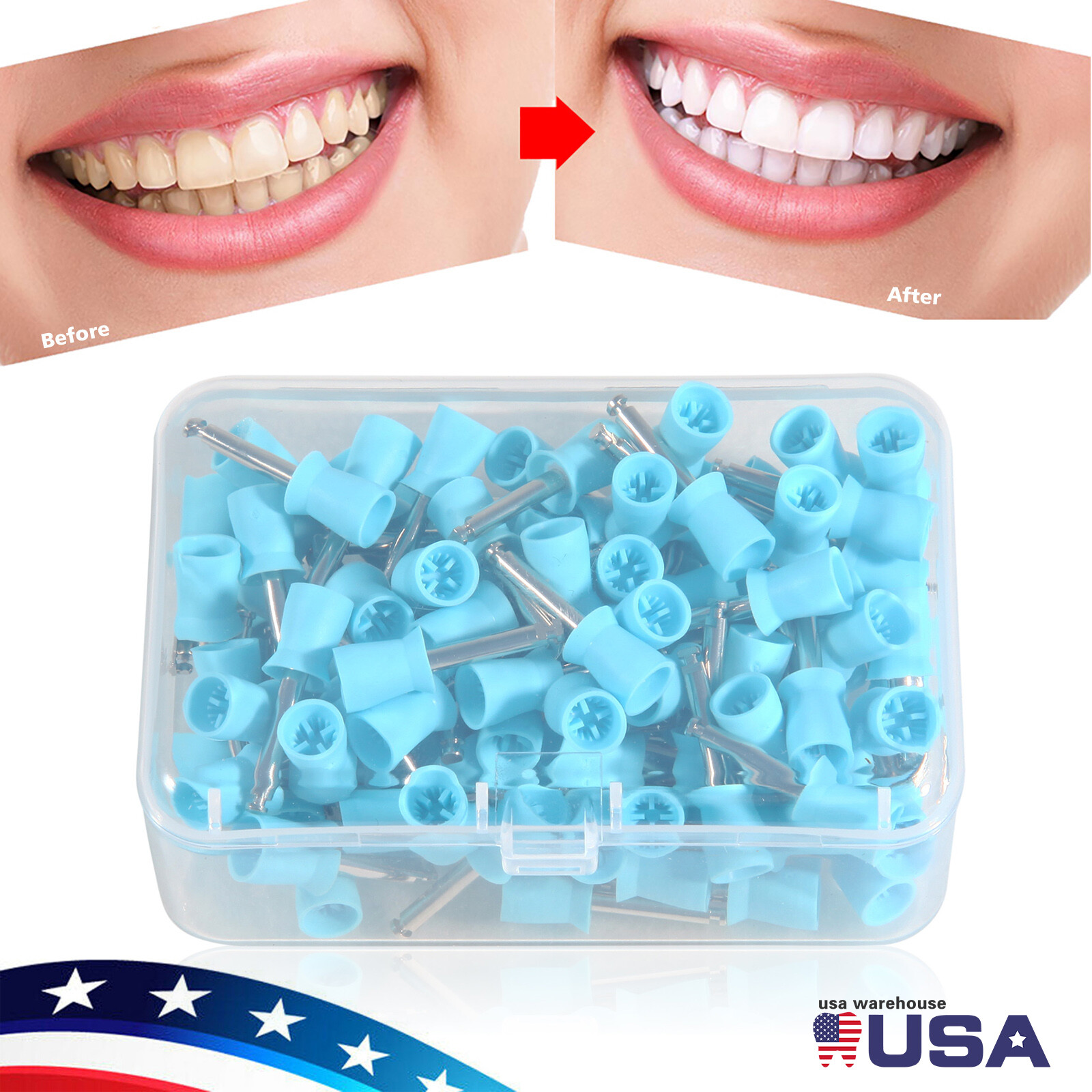 1000pcs Dental Rubber Prophy Tooth Teeth Polish Polishing Cups Latch Type Brush
