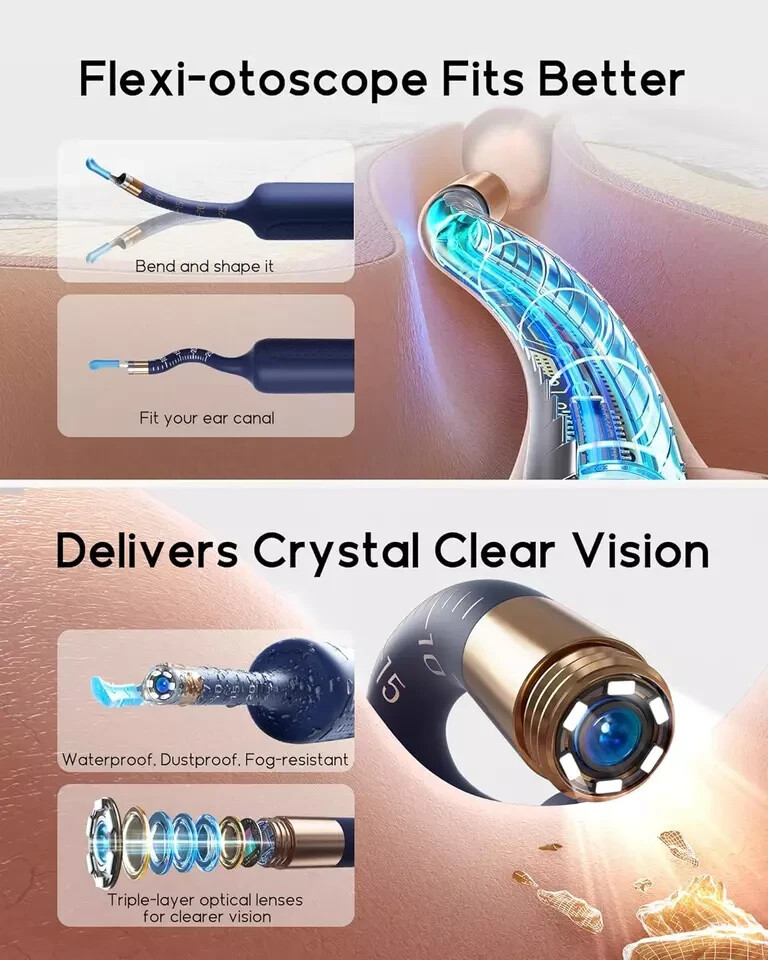 Bebird Earsight plus Ear Cleaning Camera Wax Removal Tool Kit