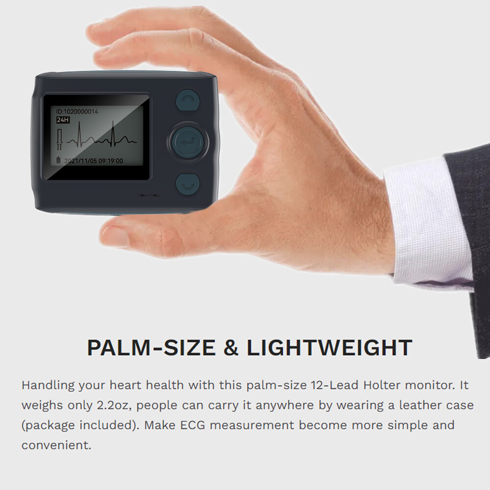 12 Lead Holter Monitor Recording 24h ECG and Heart Rate AI Analysis Abnormal ECG