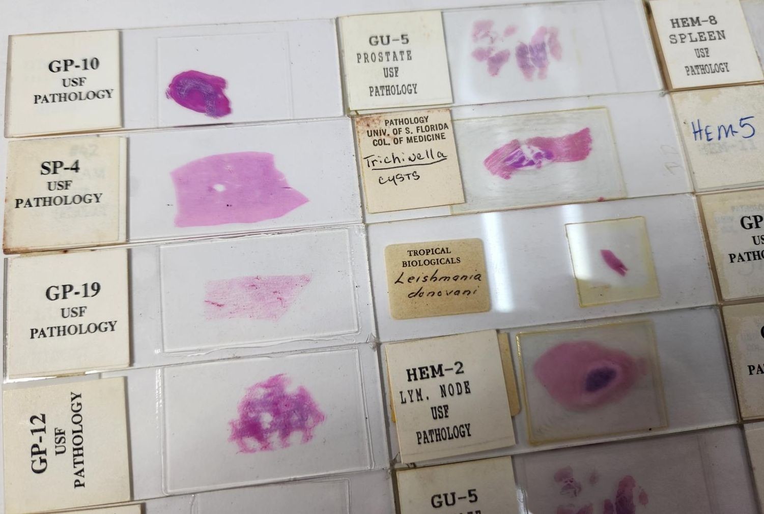 Lot Of 50 Vintage University Prepared Pathology Microscope Slides - Slides Only
