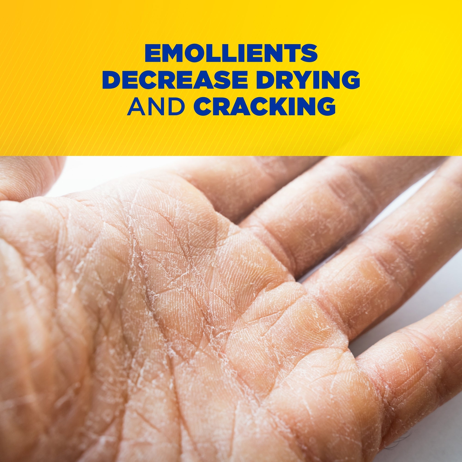 Zep Cherry Bomb LV Industrial Hand Cleaner - 1 Gal (Case of 4) - 329124