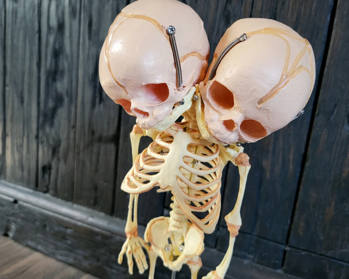 2 Headed Fetal Skeleton, Conjoined Twins Skeleton Model, 2 Head Baby, Oddities