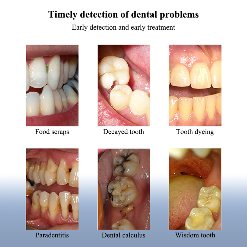 Dental Intraoral Camera USB / Wifi Digital Imaging Intra Oral NEW