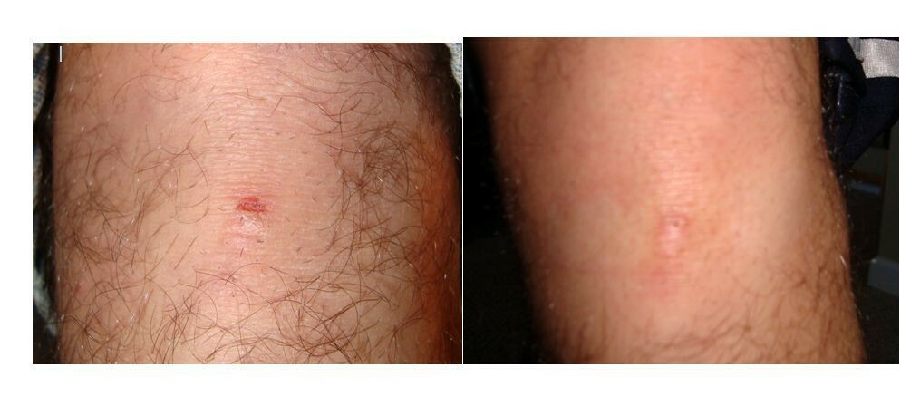 Grandmas Healing Products 1oz- Pine Tar Salve - A Black Drawing Ointment