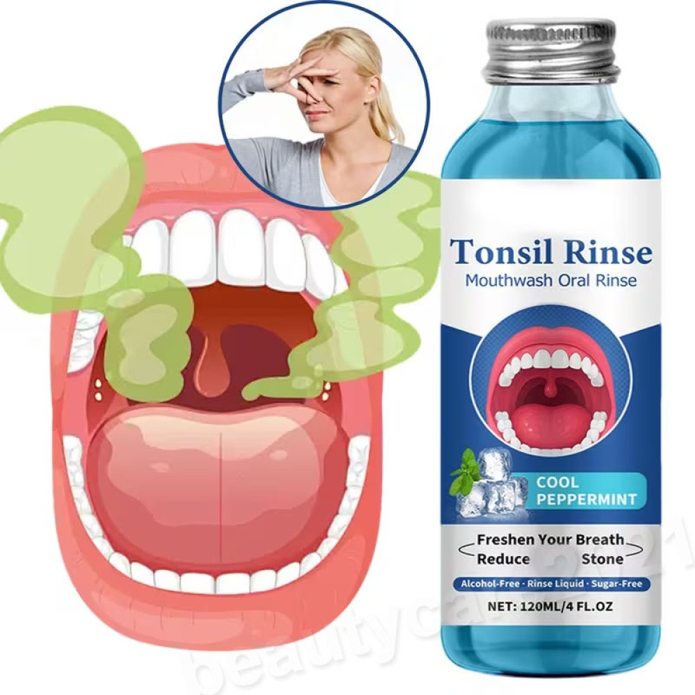 20/5X Natural Tonsil Stone Remover Rinse Mouthwash & Bad Breath Treatment 120ml