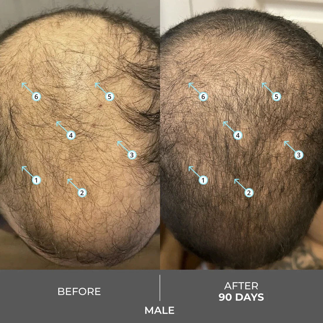 Revita Extra Strength Hair Density Shampoo for Hair Growth for Men and Women