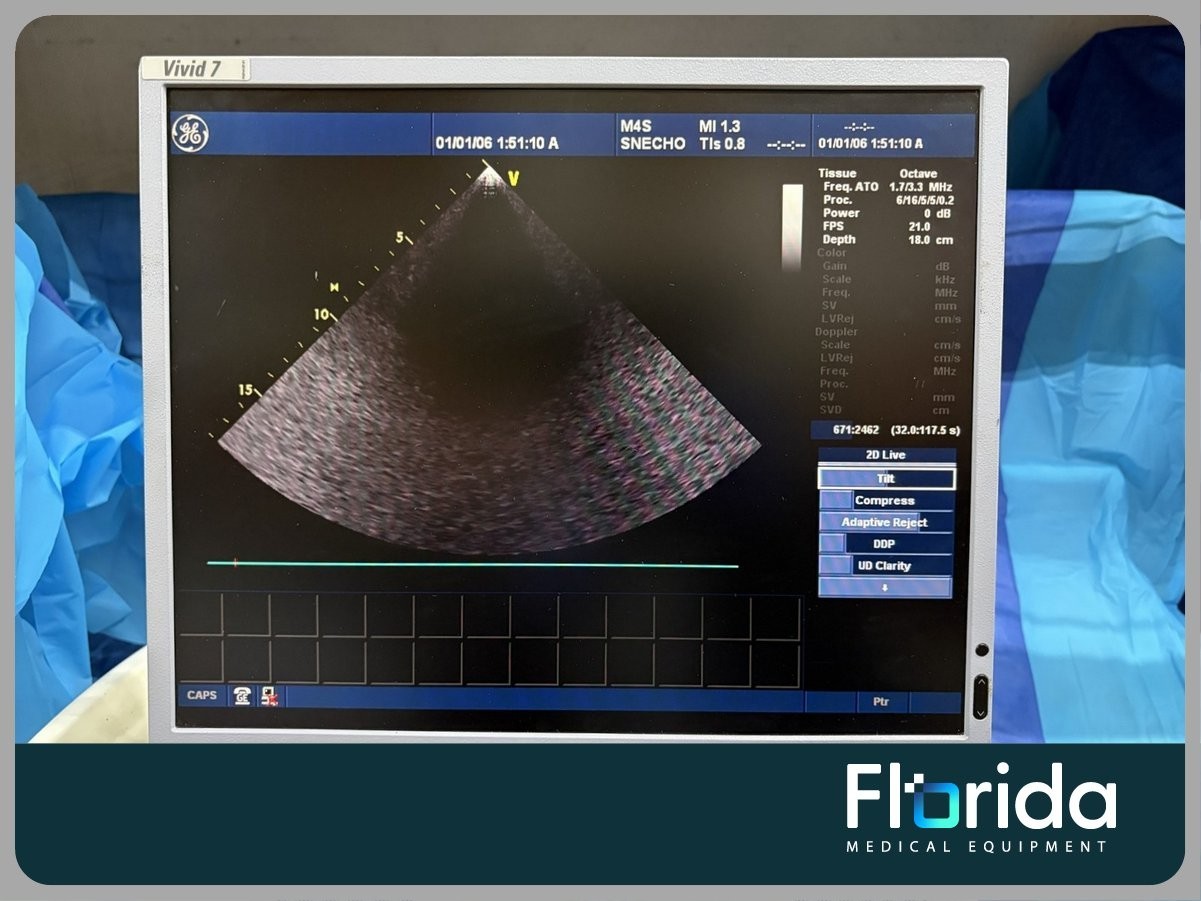 2013 GE M4S SECTOR ARRAY ULTRASOUND TRANSDUCER PROBE REF: 5129041 TESTED