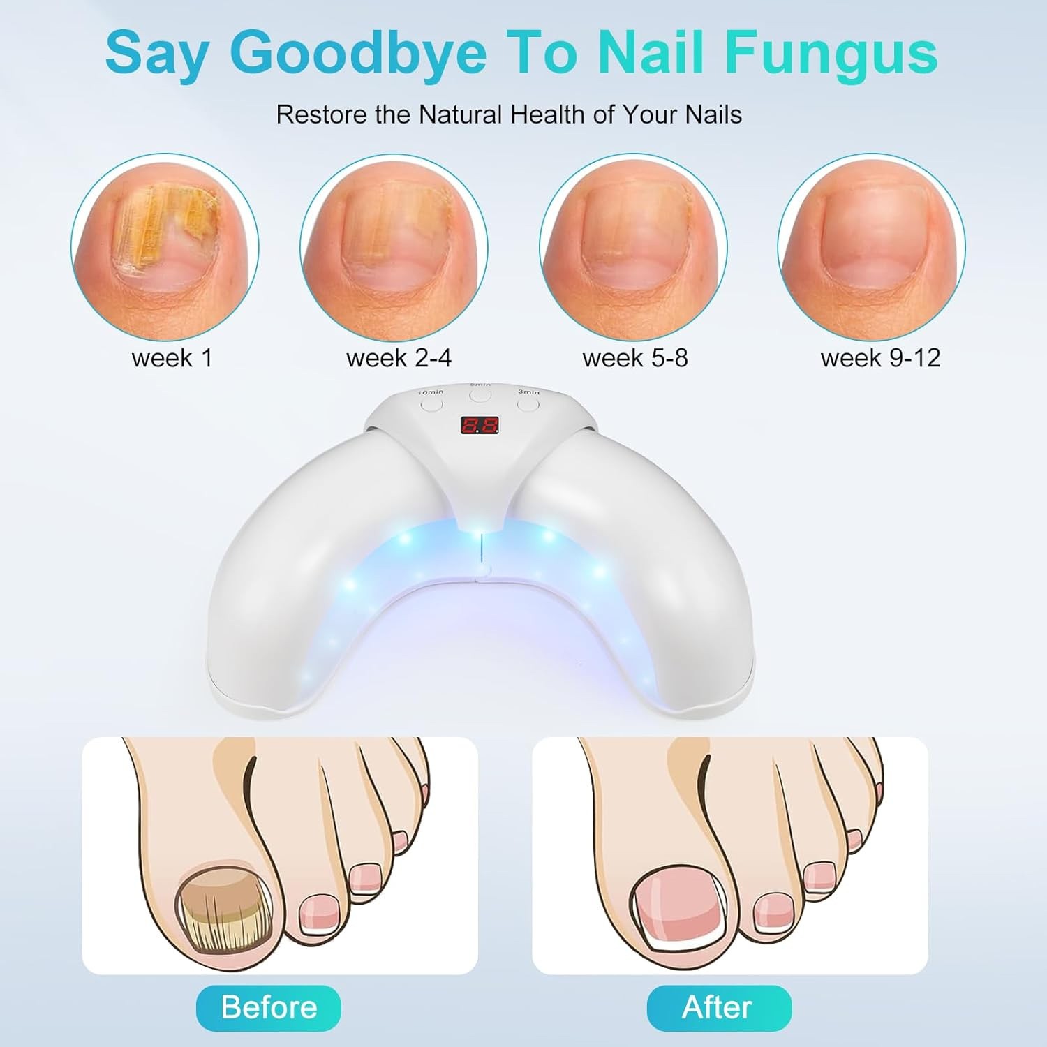 Nail Fungus Laser Nail Fungus Cleaning LED Light Device for Multiple Toenail US