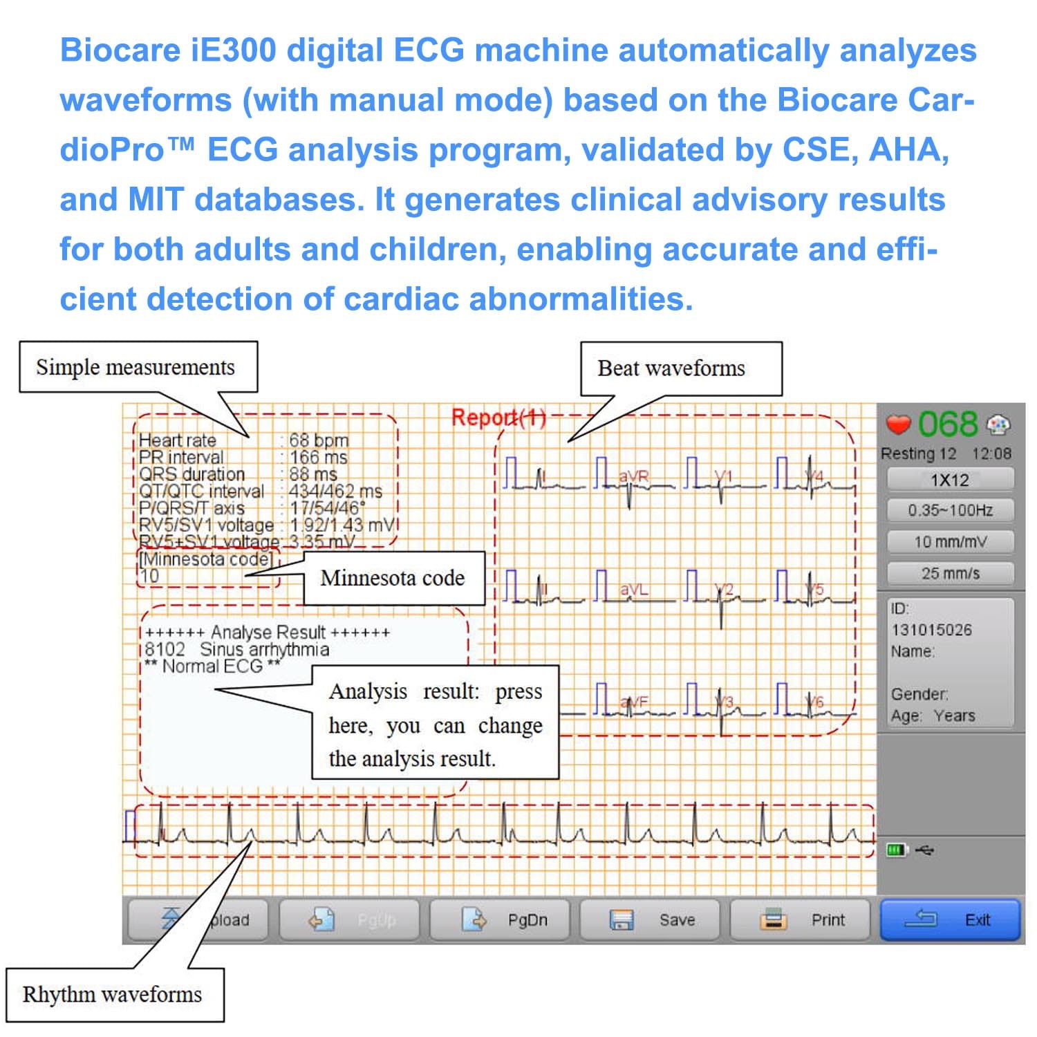 Professional Portable 12-Lead EKG Machine 3-Channel ECG with Analysis & Printer