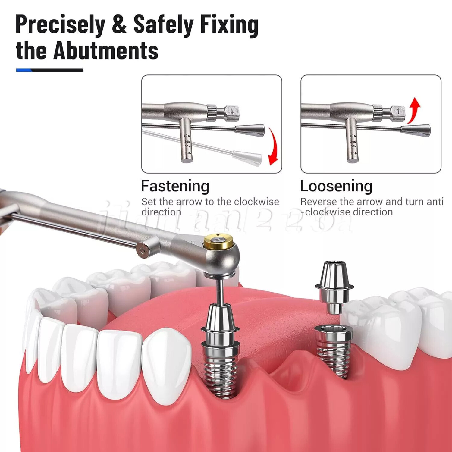 Universal Implant Prosthetic Kit Screwdriver Hex Driver Torque Wrench