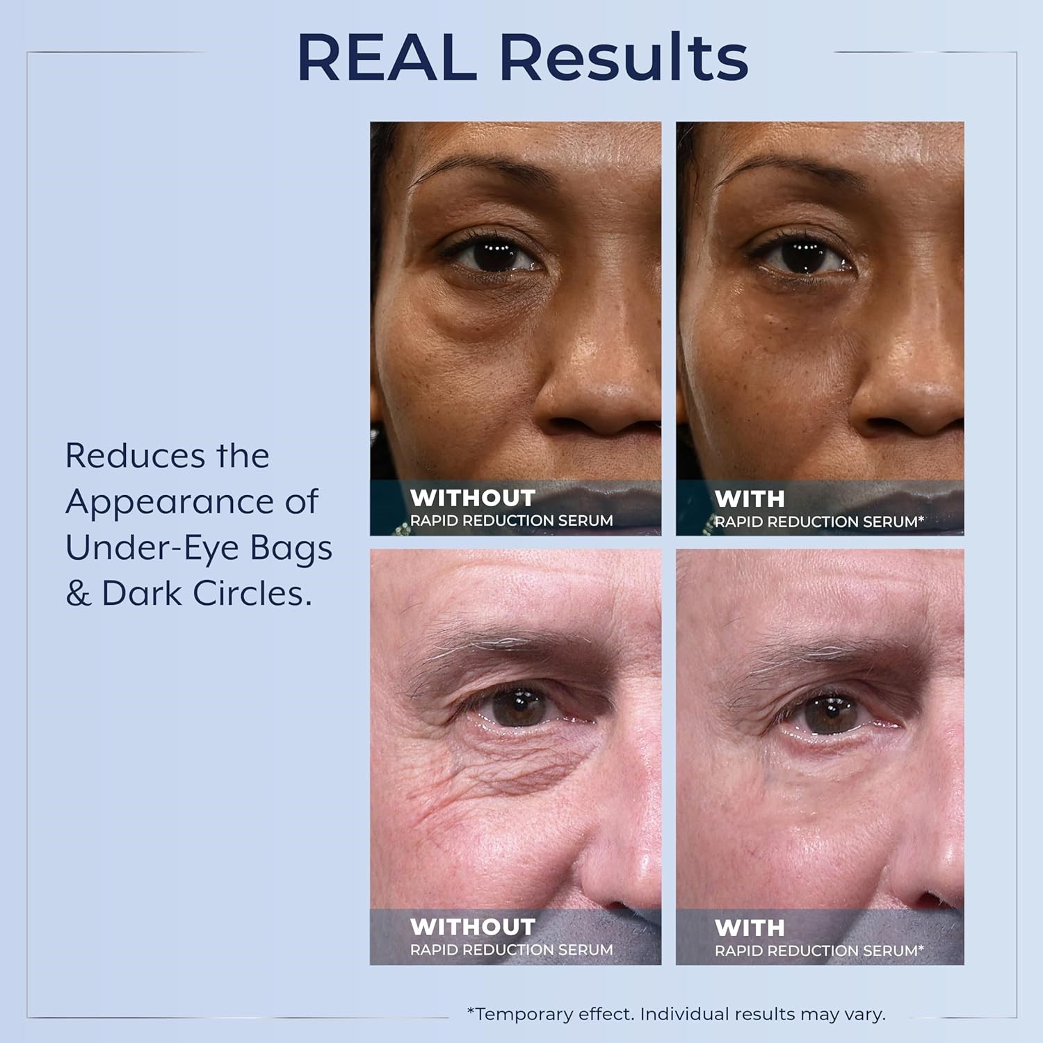 Plexaderm Rapid Reduction Eye Serum - Visibly Reduces Under-Eye Bags, Wrinkles🔥