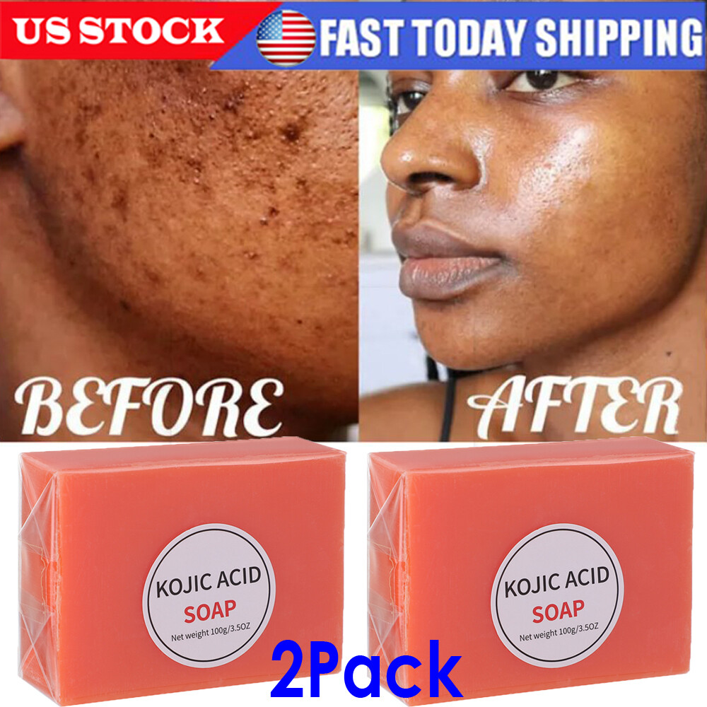 5/3X Skin Brightening Soap Original Kojic Acid Soap for Dark Spot Whitening 100g